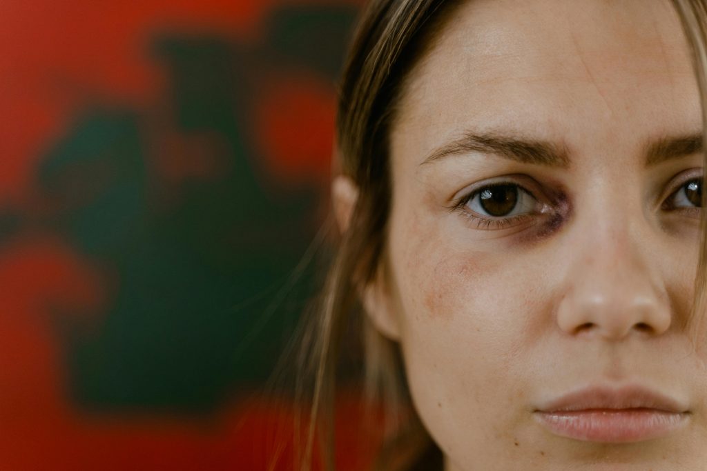 What emotional trauma can look like